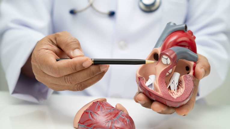 Mi okozza ténylegesen a stroke-ot és a szívinfarktust? – Csak így lehet megelőzni! 1.